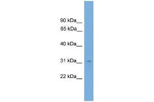 Human COLO205; WB Suggested Anti-NRBF2 Antibody Titration: 0. (NRBF2 Antikörper  (N-Term))