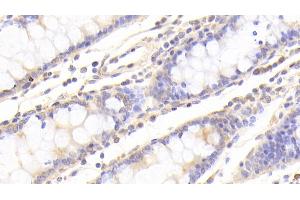 Immunohistochemistry (IHC) image for anti-Caspase 7, Apoptosis-Related Cysteine Peptidase (CASP7) (AA 207-303) antibody (ABIN7431803)