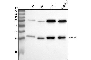 Western blot analysis of PMAIP1 using anti-PMAIP1 antibody (ABIN7605739).