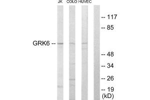 Western Blotting (WB) image for anti-G Protein-Coupled Receptor Kinase 6 (GRK6) (N-Term) antibody (ABIN1849364)