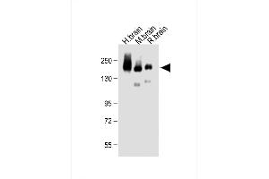 All lanes : Anti-NC Antibody (C-term) at 1:500 dilution Lane 1: Human brain lysate Lane 2: Mouse brain lysate Lane 3: Rat brain lysate Lysates/proteins at 20 μg per lane. (CD56 Antikörper  (C-Term))