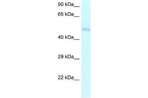Human Jurkat; WB Suggested Anti-AMBN Antibody. (AMBN Antikörper  (C-Term))