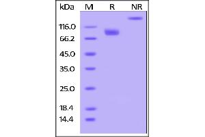 SDS-PAGE (SDS) image for Poliovirus Receptor (PVR) (AA 21-343) (Active) protein (Fc Tag) (ABIN4949085)