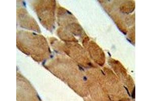 IHC analysis of FFPE human skeletal muscle stained with RANKL antibody (RANKL Antikörper  (AA 1-30))