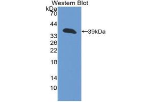 Western blot analysis of the recombinant protein. (Cytokeratin 13 Antikörper  (AA 104-403))