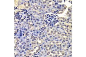 Immunohistochemistry of paraffin-embedded Mouse kidney using LSM4 antibody at dilution of 1:100 (x400 lens). (LSM4 Antikörper)