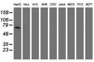 Image no. 3 for anti-alpha-Fetoprotein (AFP) antibody (ABIN1496489) (alpha Fetoprotein Antikörper)