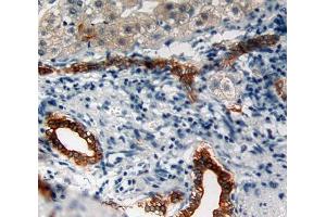 Used in DAB staining on fromalin fixed paraffin- embedded liver tissue (Cytokeratin 5 Antikörper  (AA 166-474))