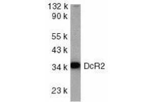 Western Blotting (WB) image for anti-Tumor Necrosis Factor Receptor Superfamily, Member 10d, Decoy with Truncated Death Domain (TNFRSF10D) (AA 249-263) antibody (ABIN2479560) (DcR2 Antikörper  (AA 249-263))