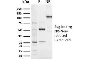 SDS-PAGE Analysis Purified Elastin Recombinant Rabbit Monoclonal Antibody (ELN/3131R). (Rekombinanter Elastin Antikörper)