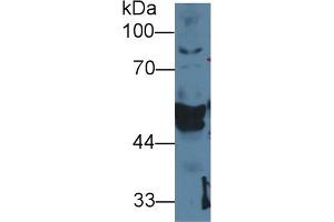 Detection of CK14 in Cavia Salivary gland lysate using Polyclonal Antibody to Cytokeratin 14 (CK14) (KRT14 Antikörper  (AA 1-484))