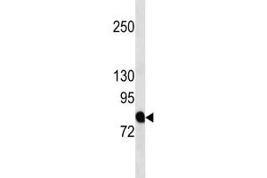Western Blotting (WB) image for anti-Amyloid beta (A4) Precursor Protein-Binding, Family B, Member 2 (APBB2) antibody (ABIN3004490)