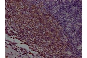 IHC image of ABIN7127370 diluted at 1:100 and staining in paraffin-embedded human appendix tissue performed on a Leica BondTM system. (Rekombinanter POU2AF1 Antikörper)