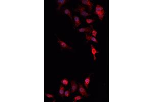 ABIN6269217 staining MCF-7 cells by IF/ICC.