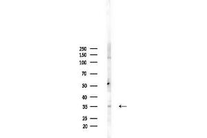 anti-Growth Hormone Inducible Transmembrane Protein (GHITM) (N-Term) antibody