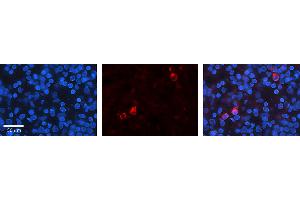 Rabbit Anti-KEAP1 Antibody   Formalin Fixed Paraffin Embedded Tissue: Human Lymph Node Tissue Observed Staining: Cytoplasm, Nucleus Primary Antibody Concentration: 1:100 Other Working Concentrations: N/A Secondary Antibody: Donkey anti-Rabbit-Cy3 Secondary Antibody Concentration: 1:200 Magnification: 20X Exposure Time: 0. (KEAP1 Antikörper  (N-Term))