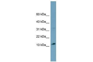 TRIM36 antibody used at 1 ug/ml to detect target protein. (TRIM36 Antikörper  (Middle Region))