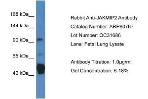 Western Blotting (WB) image for anti-Janus Kinase and Microtubule Interacting Protein 2 (JAKMIP2) (C-Term) antibody (ABIN2788569)