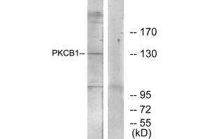 Western blot analysis of extracts from 293 cells, using PKCB1 antibody. (PKCB1 Antikörper  (Internal Region))