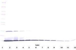 Image no. 1 for anti-Interleukin 22 (IL22) antibody (ABIN465488) (IL-22 Antikörper)
