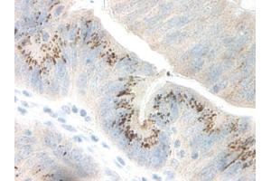 Image no. 2 for anti-Growth Regulated Oncogene gamma (GRO gamma) antibody (ABIN465908) (GRO gamma Antikörper)