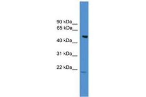 anti-Amyotrophic Lateral Sclerosis 2 (Juvenile) Chromosome Region, Candidate 12 (ALS2CR12) (AA 110-159) antibody