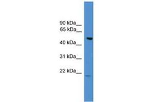 Image no. 1 for anti-Amyotrophic Lateral Sclerosis 2 (Juvenile) Chromosome Region, Candidate 12 (ALS2CR12) (AA 110-159) antibody (ABIN6745420) (ALS2CR12 Antikörper  (AA 110-159))