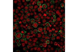 Immunofluorescence staining of MOLT-4 cells using CD20 Monoclonal Antibody (SPM494) followed by goat anti-Mouse IgG conjugated to CF488 (green). (CD20 Antikörper)