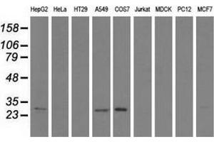 Western blot analysis of extracts (35 µg) from 9 different cell lines by using anti-SPR monoclonal antibody. (SPR Antikörper)