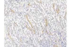 anti-Dynein, Axonemal, Heavy Chain 1 (DNAH1) (Internal Region) antibody