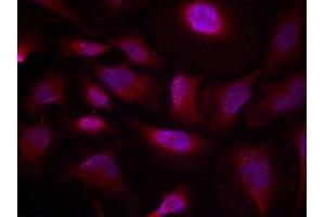 Immunofluorescence staining of methanol-fixed Hela cells using ATF2(Phospho-Thr73 or 55) Antibody.