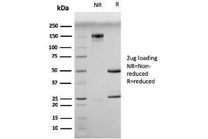 SDS-PAGE Analysis Purified Myogenin Mouse Monoclonal Antibody (MGN185). (Myogenin Antikörper)