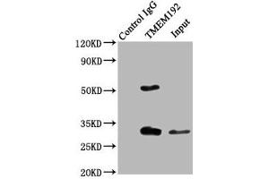 Immunoprecipitating TMEM192 in Jurkat whole cell lysate Lane 1: Rabbit control IgG (1 μg) instead of ABIN7173123 in Jurkat whole cell lysate. (TMEM192 Antikörper  (AA 193-271))