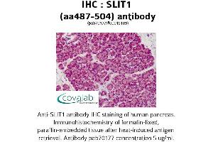 Image no. 1 for anti-Slit Homolog 1 (SLIT1) (AA 487-504) antibody (ABIN1739431) (SLIT1 Antikörper  (AA 487-504))