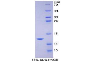 SDS-PAGE analysis of Human FABP3 Protein. (FABP3 Protein)
