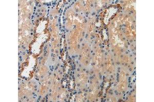 Used in DAB staining on fromalin fixed paraffin- embedded kidney tissue (IGFBP6 Antikörper  (AA 31-240))