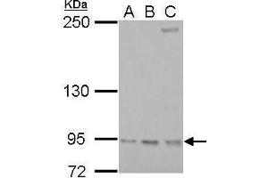 Western Blotting (WB) image for anti-Ribonucleotide Reductase M1 (RRM1) (Center) antibody (ABIN2854856)