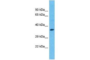 Host:  Rabbit  Target Name:  ISL1  Sample Type:  Breast Tumor lysates  Antibody Dilution:  1. (ISL1 Antikörper  (C-Term))