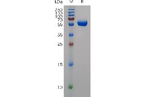 SDS-PAGE (SDS) image for Matrix Metallopeptidase 9 (Gelatinase B, 92kDa Gelatinase, 92kDa Type IV Collagenase) (MMP9) (AA 20-469) protein (His tag) (ABIN7490819)