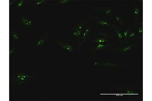 Immunofluorescence of purified MaxPab antibody to UTP18 on HeLa cell.