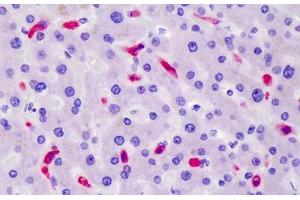Human Liver: Formalin-Fixed, Paraffin-Embedded (FFPE) (CD163 Antikörper)