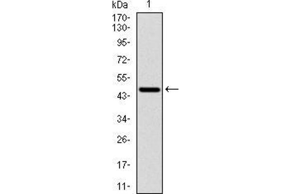 RPS6KB1 Antikörper