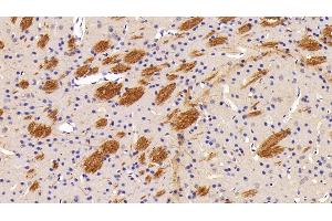 Detection of Flt3L in Mouse Cerebrum Tissue using Polyclonal Antibody to FMS Like Tyrosine Kinase 3 Ligand (Flt3L) (FLT3LG Antikörper  (AA 27-189))