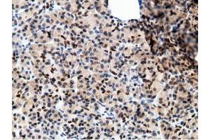 Image no. 9 for anti-EPM2A (Laforin) Interacting Protein 1 (EPM2AIP1) antibody (ABIN1498047) (EPM2AIP1 Antikörper)