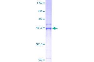 ORM1 Protein (AA 18-201) (GST tag)