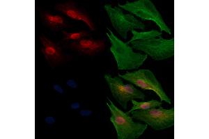 ABIN6261941 and ABIN6272525 staining  cells by IF/ICC.