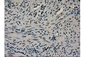 Immunohistochemical staining of paraffin-embedded Ovary tissue using anti-CTAG1Bmouse monoclonal antibody. (CTAG1B Antikörper)