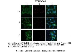 Application: IHC/Immunofluorescence Species+tissue/cell type:A. (ATP6V0A2 Antikörper  (N-Term))