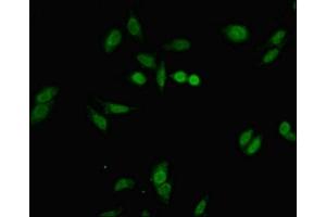 Immunofluorescent analysis of Hela cells using ABIN7152677 at dilution of 1:100 and Alexa Fluor 488-congugated AffiniPure Goat Anti-Rabbit IgG(H+L) (FERD3L Antikörper  (AA 1-167))