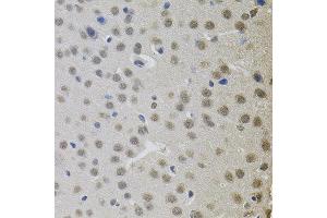 Immunohistochemistry of paraffin-embedded mouse brain using MKL1 antibody.